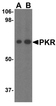 EIF2AK2 Antibody