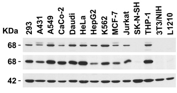 EIF2AK2 Antibody