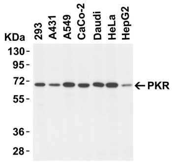 EIF2AK2 Antibody