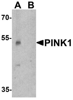 PINK1 Antibody