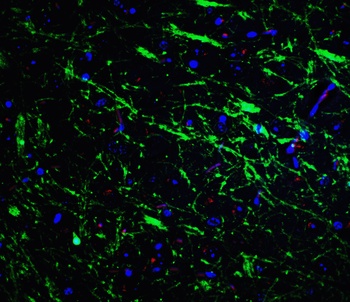 PINK1 Antibody