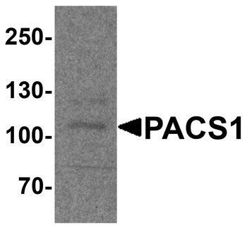 PACS1 Antibody