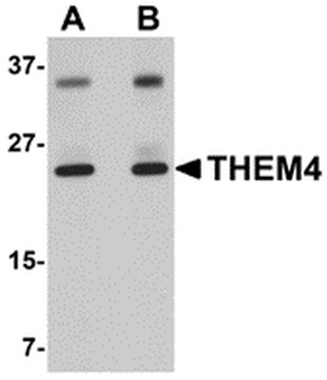 THEM4 Antibody