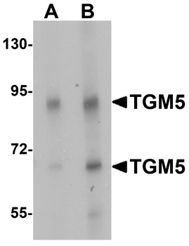 TGM5 Antibody