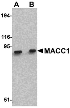 MACC1 Antibody