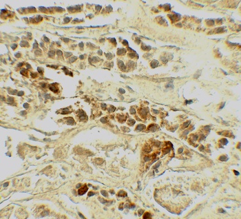TERF2 Antibody