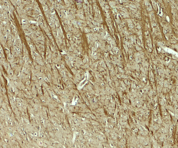 TENM3 Antibody