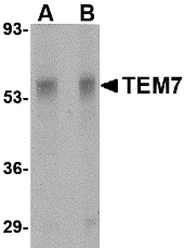 PLXDC1 Antibody