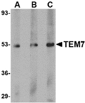 PLXDC1 Antibody