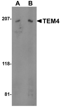 ARHGEF17 Antibody