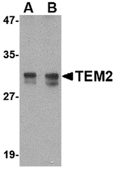 TEM2 Antibody
