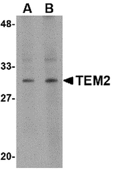 TEM2 Antibody