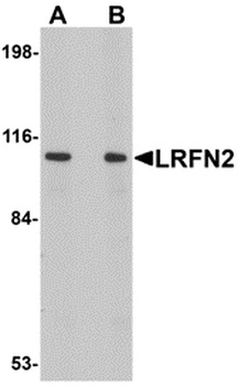 LRFN2 Antibody