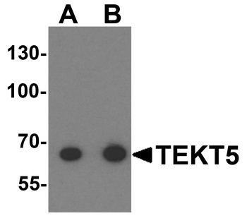TEKT5 Antibody