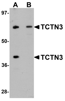 TCTN3 Antibody
