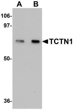 TCTN1 Antibody