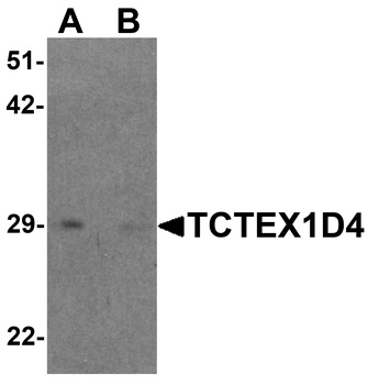 TCTEX1D4 Antibody