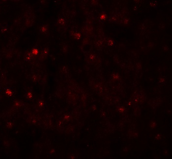 TCTEX1D4 Antibody