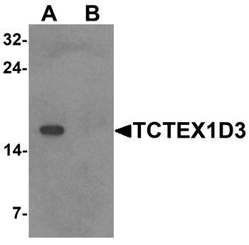 TCTEX1D3 Antibody