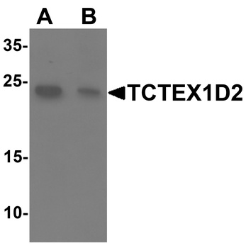 TCTEX1D2 Antibody