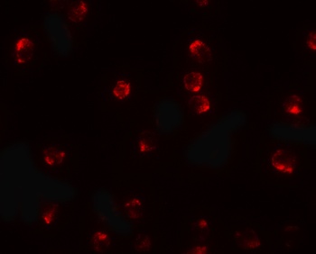 TCTEX1D2 Antibody