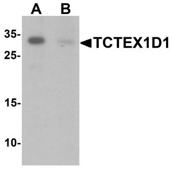 TCTEX1D1 Antibody