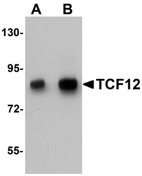 TCF12 Antibody