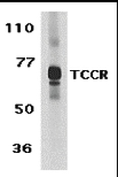 TCCR Antibody