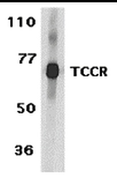 TCCR Antibody