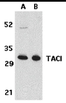 TNFRSF13B Antibody