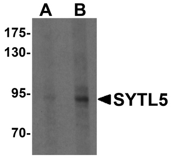 SYTL5 Antibody
