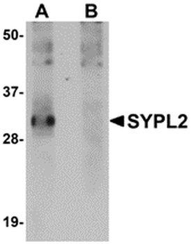 SYPL2 Antibody