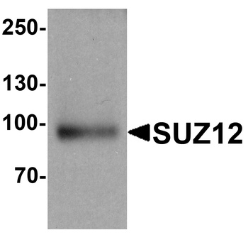 SUZ12 Antibody