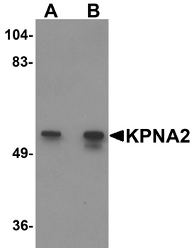 KPNA2 Antibody