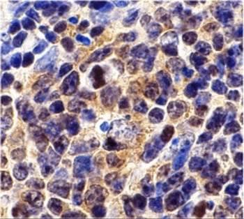 BIRC5 Antibody