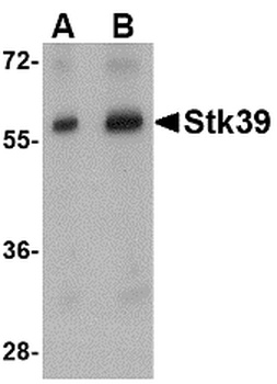 STK39 Antibody