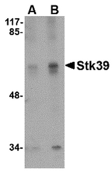 STK39 Antibody