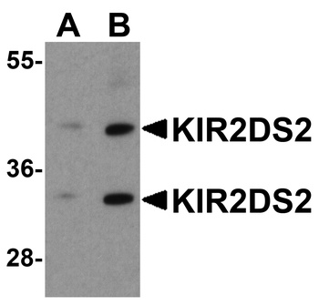 KIR2DS2 Antibody