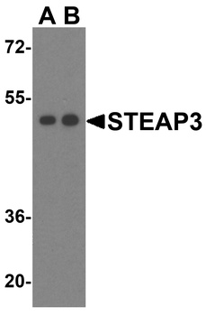 STEAP3 Antibody