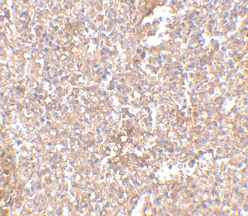 STEAP1 Antibody
