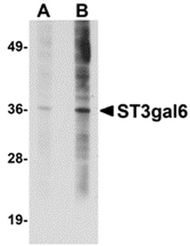 ST3GAL6 Antibody