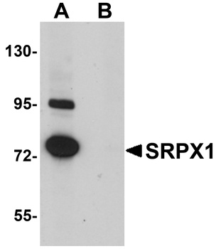 SRPX Antibody