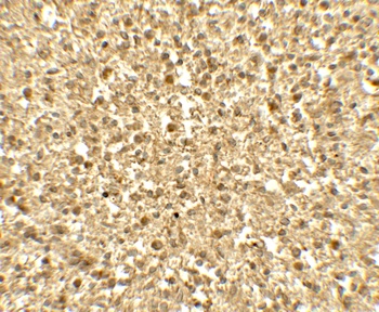 SREBF1 Antibody