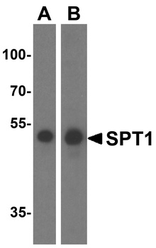 SPT1 Antibody