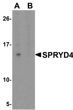 SPRYD4 Antibody