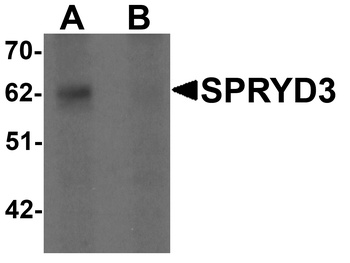 SPRYD3 Antibody