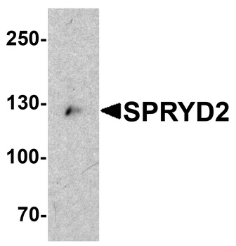 SPRYD2 Antibody