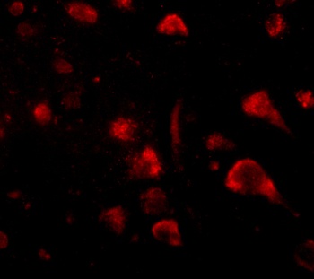 SPRED3 Antibody