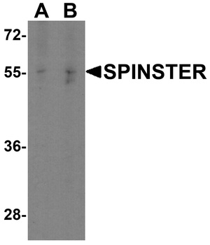 SPNS1 Antibody