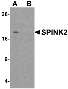 SPINK2 Antibody